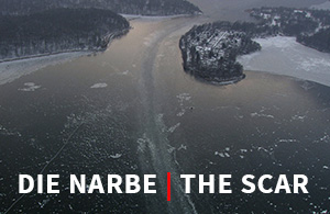 THE SCAR PROJECT / DAS NARBE PROJEKT by Burkhard Philipp von Harder